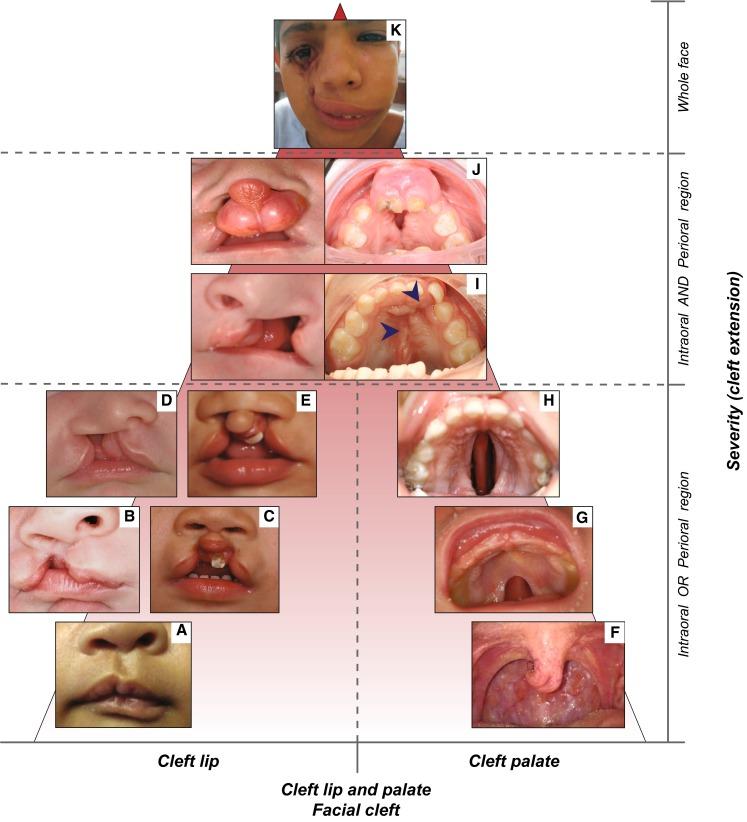 https://cdn.ncbi.nlm.nih.gov/pmc/blobs/4d57/5065589/e8c8f0516846/439_2016_1733_Fig2_HTML.jpg