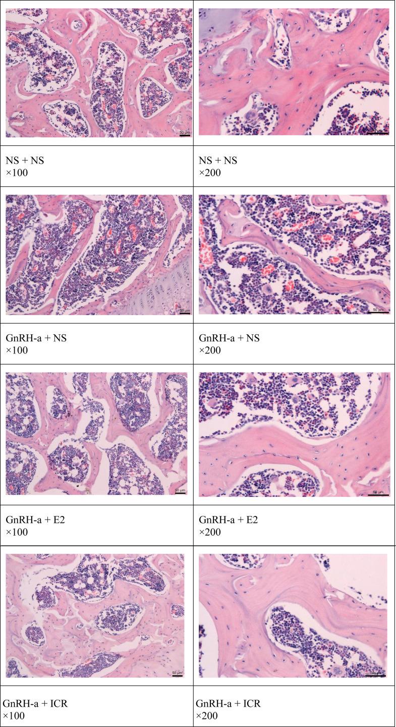 https://cdn.ncbi.nlm.nih.gov/pmc/blobs/4d5f/9224413/91aa152a13c0/fendo-13-854345-g002.jpg