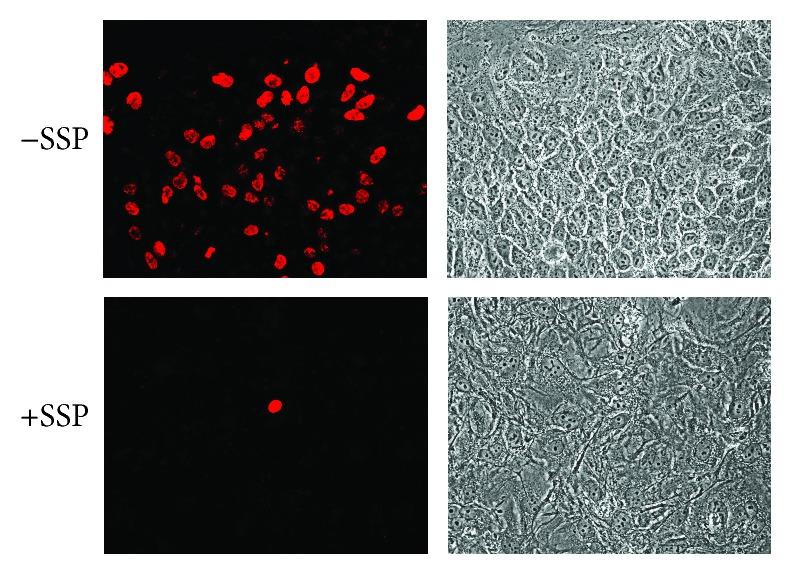 https://cdn.ncbi.nlm.nih.gov/pmc/blobs/4d64/6199859/c9c3116e2f41/ACP2018-1754085.004.jpg