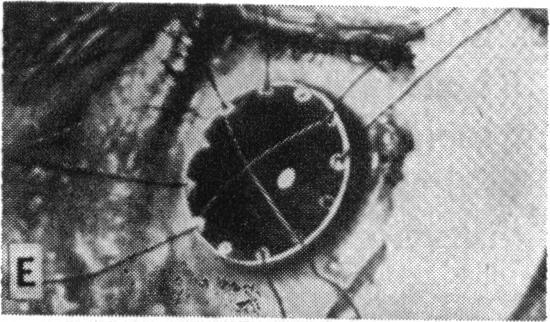https://cdn.ncbi.nlm.nih.gov/pmc/blobs/4d67/1312688/9d8a4b6b7023/taos00044-0592-f.jpg