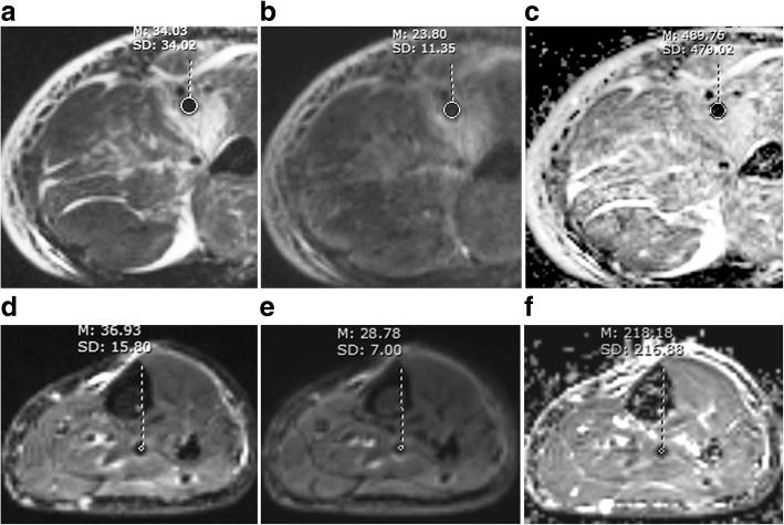 https://cdn.ncbi.nlm.nih.gov/pmc/blobs/4d6d/6615231/821ce8ec9d2e/12968_2019_552_Fig5_HTML.jpg