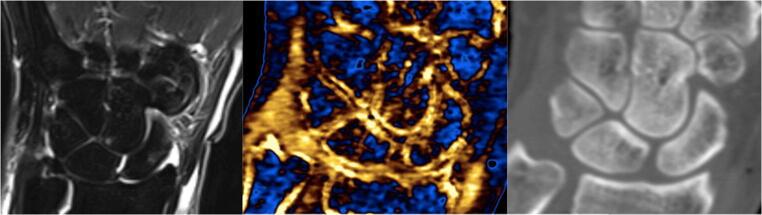 https://cdn.ncbi.nlm.nih.gov/pmc/blobs/4d70/8128856/6ccf3f0f1e9d/330_2020_7604_Fig4_HTML.jpg
