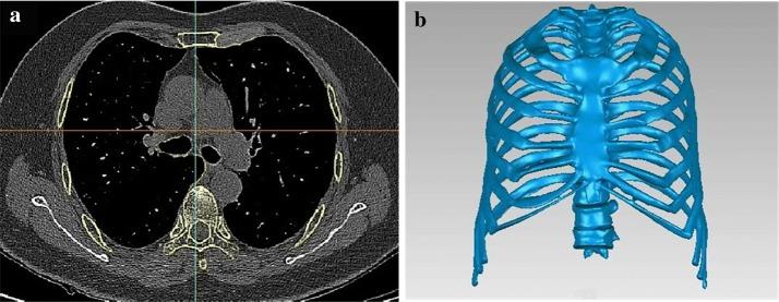 https://cdn.ncbi.nlm.nih.gov/pmc/blobs/4d73/6444614/b29abe19381f/12938_2019_652_Fig1_HTML.jpg