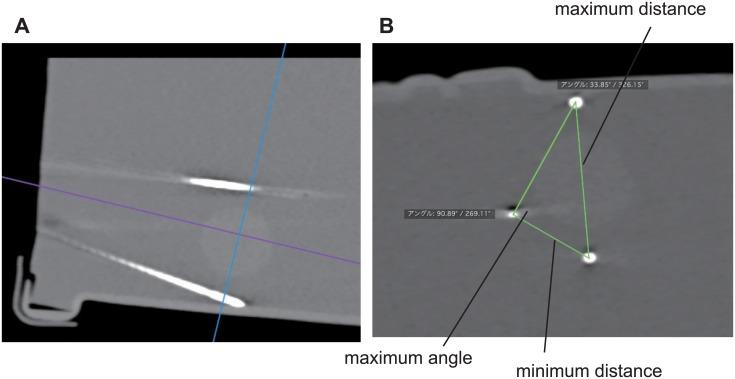 https://cdn.ncbi.nlm.nih.gov/pmc/blobs/4d7a/4742253/530266d0e3db/pone.0148298.g008.jpg