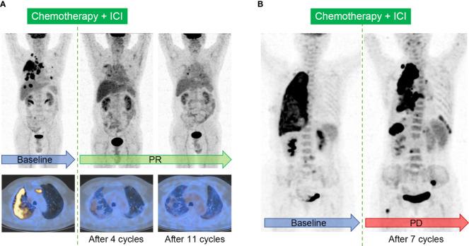 https://cdn.ncbi.nlm.nih.gov/pmc/blobs/4d82/9630646/468eedb5343d/fimmu-13-1049043-g004.jpg