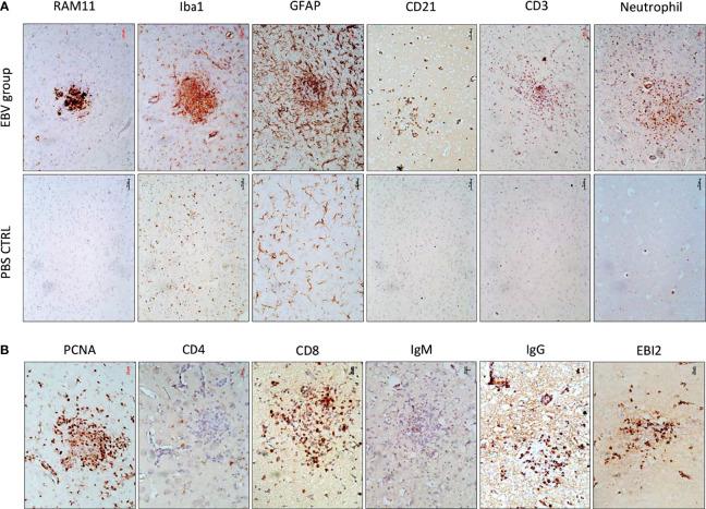 https://cdn.ncbi.nlm.nih.gov/pmc/blobs/4d86/8656284/2638e7b27bff/fimmu-12-764937-g003.jpg