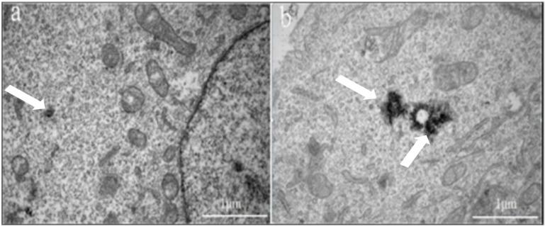 https://cdn.ncbi.nlm.nih.gov/pmc/blobs/4d8c/5820924/5aafe622cc5a/jcav09p0564g006.jpg