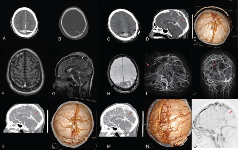 https://cdn.ncbi.nlm.nih.gov/pmc/blobs/4d8d/5459734/44eb853b1460/medi-96-e7055-g002.jpg