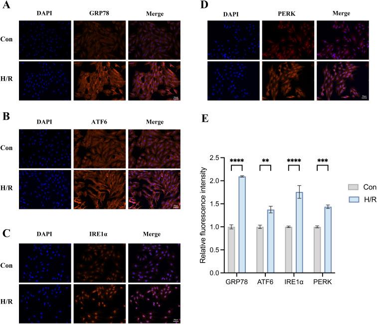 https://cdn.ncbi.nlm.nih.gov/pmc/blobs/4d8e/11627109/64a28837951f/JIR-17-10495-g0010.jpg
