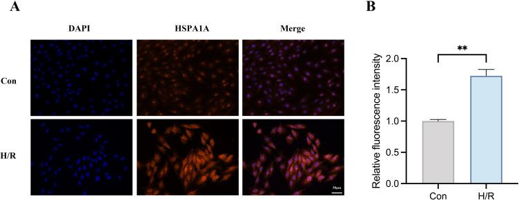 https://cdn.ncbi.nlm.nih.gov/pmc/blobs/4d8e/11627109/eb85ddf6b993/JIR-17-10495-g0011.jpg
