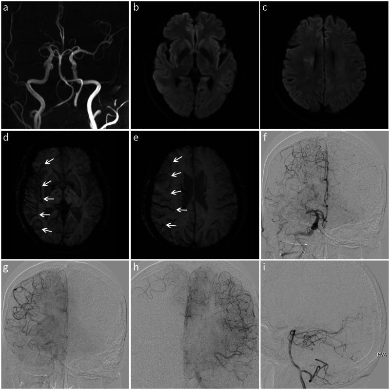 https://cdn.ncbi.nlm.nih.gov/pmc/blobs/4d8f/8161861/ddb852bc430e/10.1177_03000605211013179-fig2.jpg