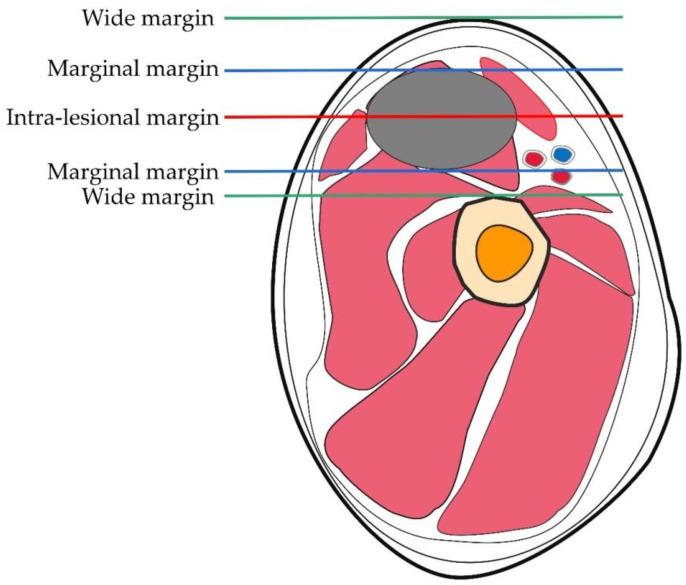 https://cdn.ncbi.nlm.nih.gov/pmc/blobs/4d90/9653755/760583edc6cd/cells-11-03507-g001.jpg