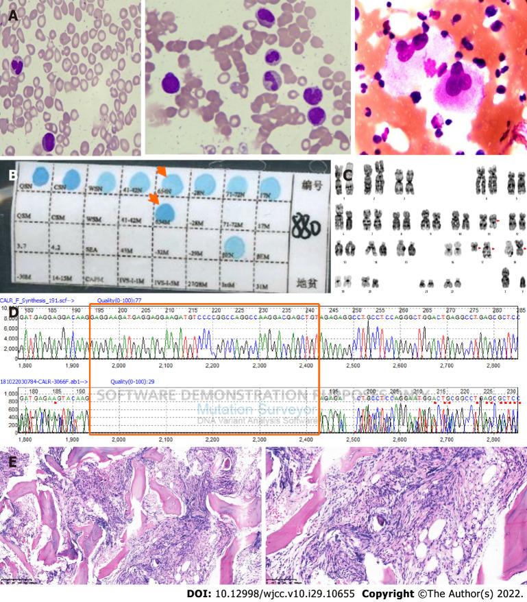 https://cdn.ncbi.nlm.nih.gov/pmc/blobs/4d93/9602234/3ed4f1e96001/WJCC-10-10655-g002.jpg