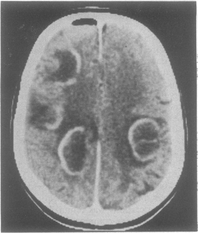 https://cdn.ncbi.nlm.nih.gov/pmc/blobs/4d97/1014315/09984ec9e039/jnnpsyc00499-0102-a.jpg