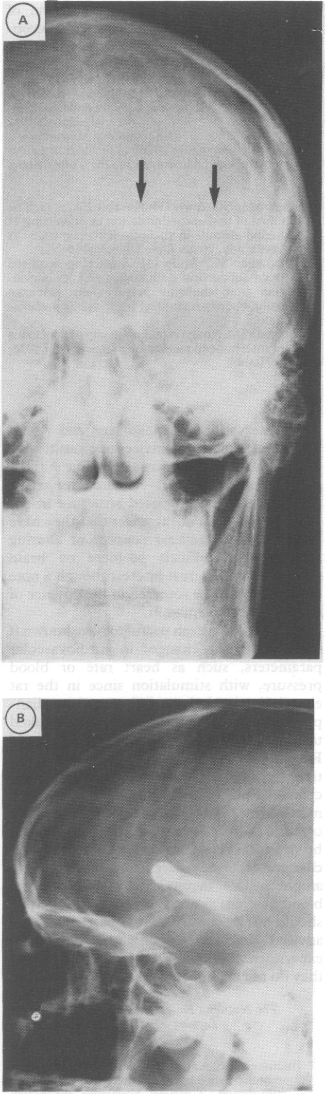 https://cdn.ncbi.nlm.nih.gov/pmc/blobs/4d97/1014315/4854140c1cd2/jnnpsyc00499-0103-a.jpg