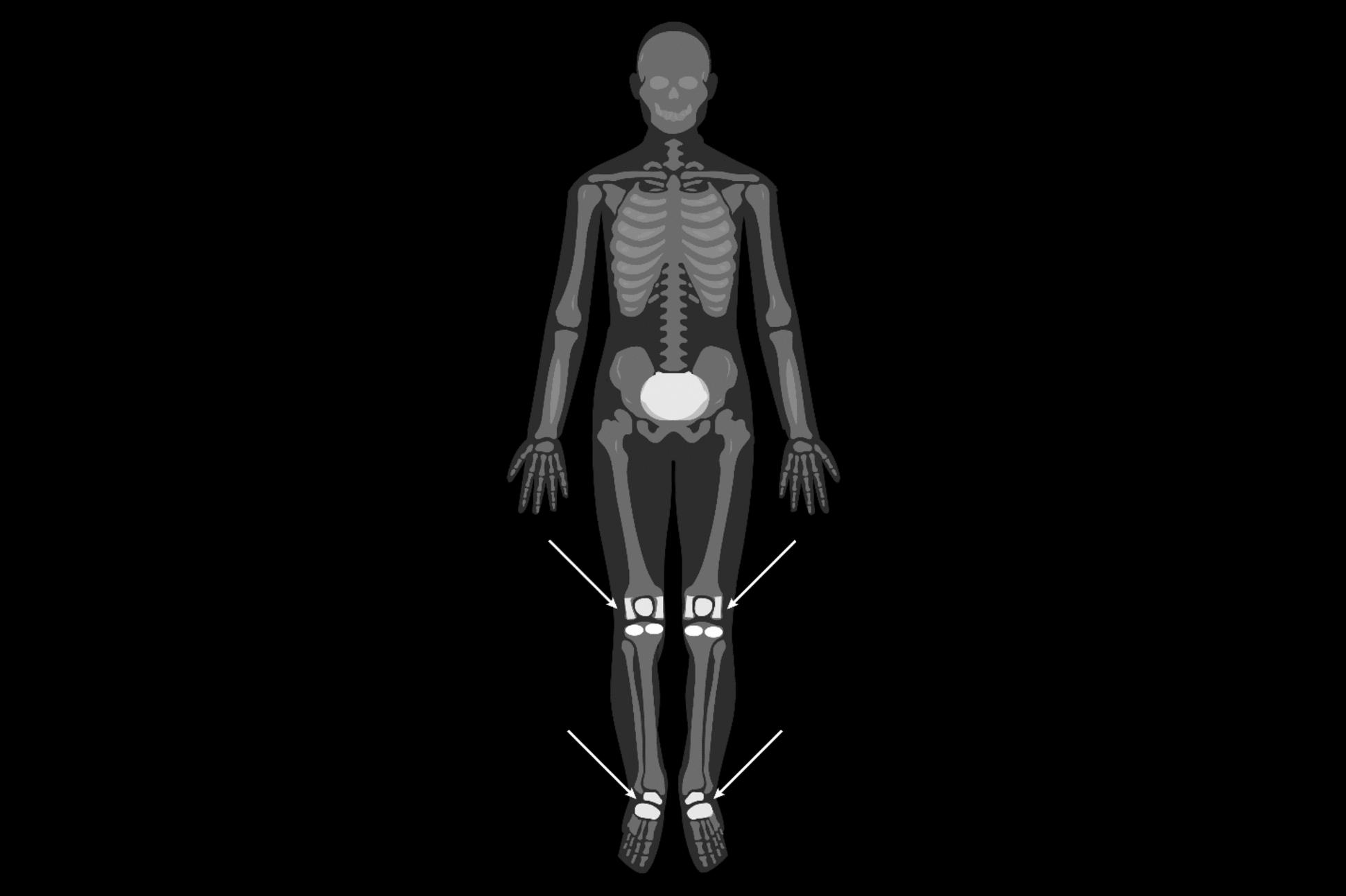 https://cdn.ncbi.nlm.nih.gov/pmc/blobs/4d97/11912602/bc9372bb2651/40001_2025_2357_Fig1_HTML.jpg