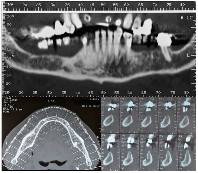 https://cdn.ncbi.nlm.nih.gov/pmc/blobs/4d98/6784736/1ee955ec0029/dentistry-07-00077-g002.jpg