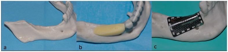 https://cdn.ncbi.nlm.nih.gov/pmc/blobs/4d98/6784736/499ffdd7fe9c/dentistry-07-00077-g003.jpg