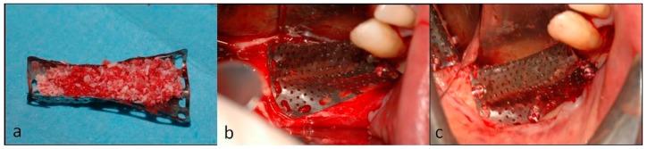 https://cdn.ncbi.nlm.nih.gov/pmc/blobs/4d98/6784736/b75b28dc4425/dentistry-07-00077-g007.jpg