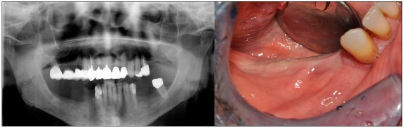 https://cdn.ncbi.nlm.nih.gov/pmc/blobs/4d98/6784736/bd2e763e84b8/dentistry-07-00077-g001.jpg