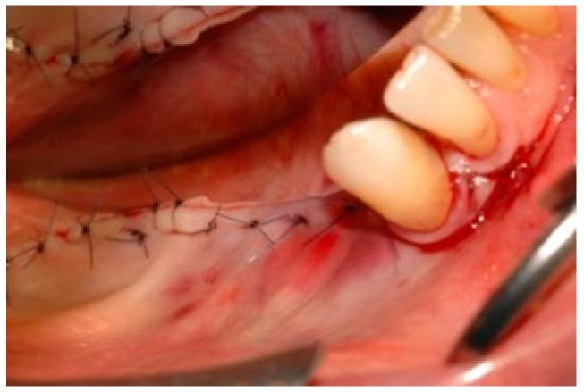 https://cdn.ncbi.nlm.nih.gov/pmc/blobs/4d98/6784736/c56fc1945156/dentistry-07-00077-g008.jpg
