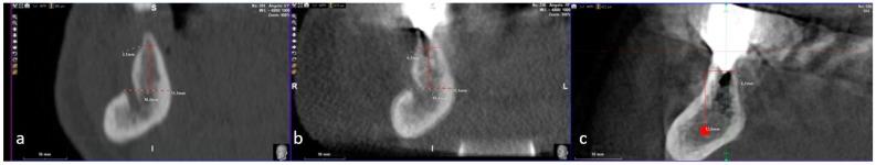https://cdn.ncbi.nlm.nih.gov/pmc/blobs/4d98/6784736/f66383f7a9ae/dentistry-07-00077-g013.jpg