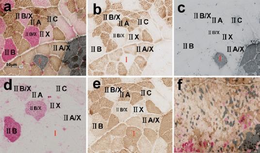 https://cdn.ncbi.nlm.nih.gov/pmc/blobs/4d9c/5607833/0956625c90b0/NRR-12-1357-g006.jpg