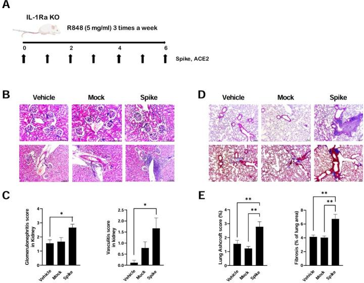 https://cdn.ncbi.nlm.nih.gov/pmc/blobs/4da8/11448135/23e6fc8bde6a/lupus-11-2-g004.jpg