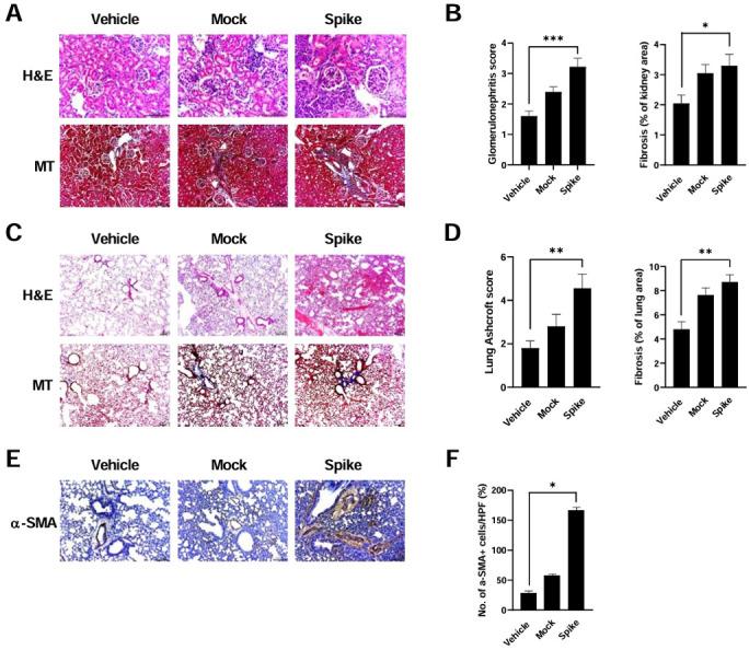 https://cdn.ncbi.nlm.nih.gov/pmc/blobs/4da8/11448135/d21d4d7d8649/lupus-11-2-g002.jpg