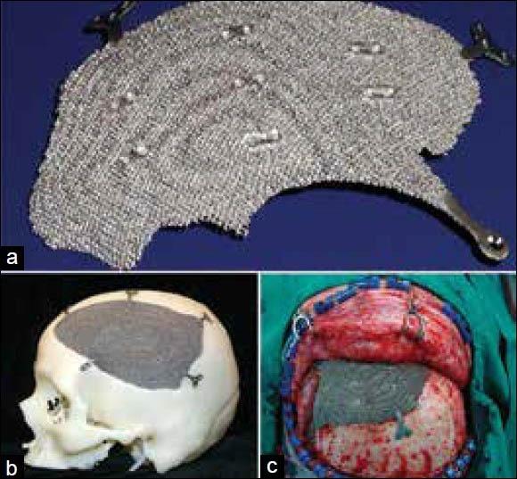 https://cdn.ncbi.nlm.nih.gov/pmc/blobs/4dac/4073471/0ac737d4c57c/AMS-4-9-g003.jpg