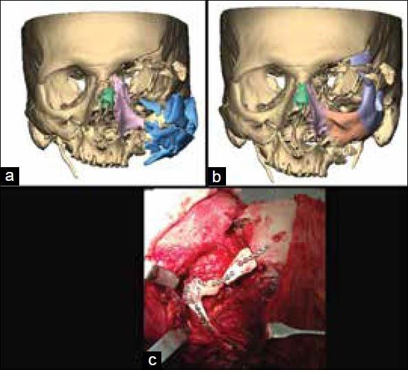 https://cdn.ncbi.nlm.nih.gov/pmc/blobs/4dac/4073471/64258a39f0d9/AMS-4-9-g013.jpg