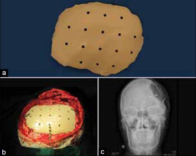 https://cdn.ncbi.nlm.nih.gov/pmc/blobs/4dac/4073471/abf36d6c5d8a/AMS-4-9-g005.jpg