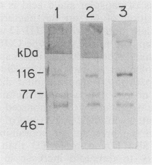 https://cdn.ncbi.nlm.nih.gov/pmc/blobs/4dae/257427/a79006d95ecc/iai00034-0053-b.jpg
