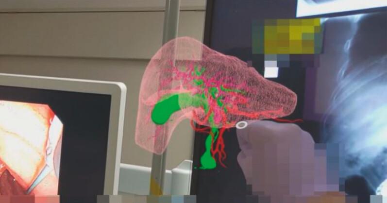 https://cdn.ncbi.nlm.nih.gov/pmc/blobs/4db3/11511617/6bb18b13c276/10-1055-a-2421-6161_24228284.jpg