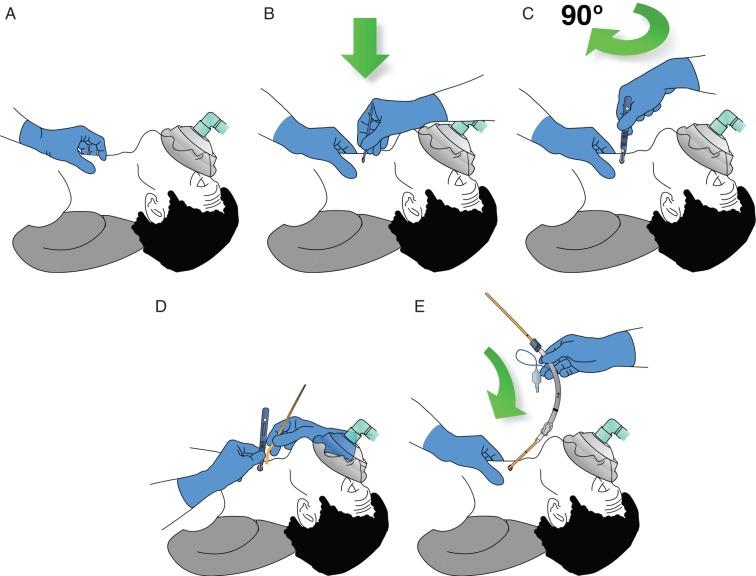 https://cdn.ncbi.nlm.nih.gov/pmc/blobs/4db5/4650961/eb37262b61a8/aev37104.jpg