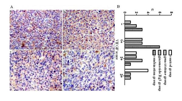 https://cdn.ncbi.nlm.nih.gov/pmc/blobs/4db8/2721848/cd7fdce17e9b/1471-2407-9-250-6.jpg