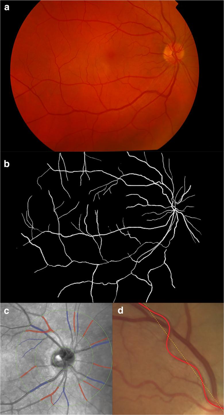 https://cdn.ncbi.nlm.nih.gov/pmc/blobs/4db8/7732888/74324d83307f/11357_2020_252_Fig2_HTML.jpg