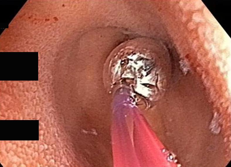 https://cdn.ncbi.nlm.nih.gov/pmc/blobs/4dbc/7652715/6cbdc5971e48/gr6.jpg