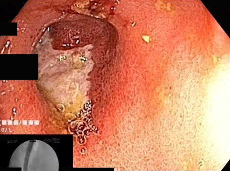 https://cdn.ncbi.nlm.nih.gov/pmc/blobs/4dbc/7652715/859442f79ff2/gr2.jpg