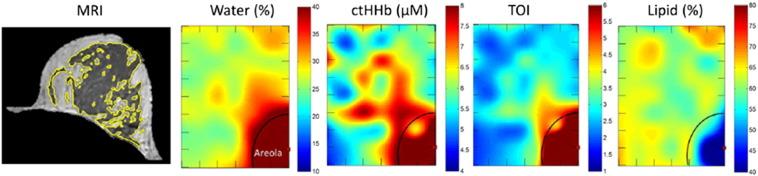 https://cdn.ncbi.nlm.nih.gov/pmc/blobs/4dc2/4700291/d4fc63c2e9fb/gr6.jpg