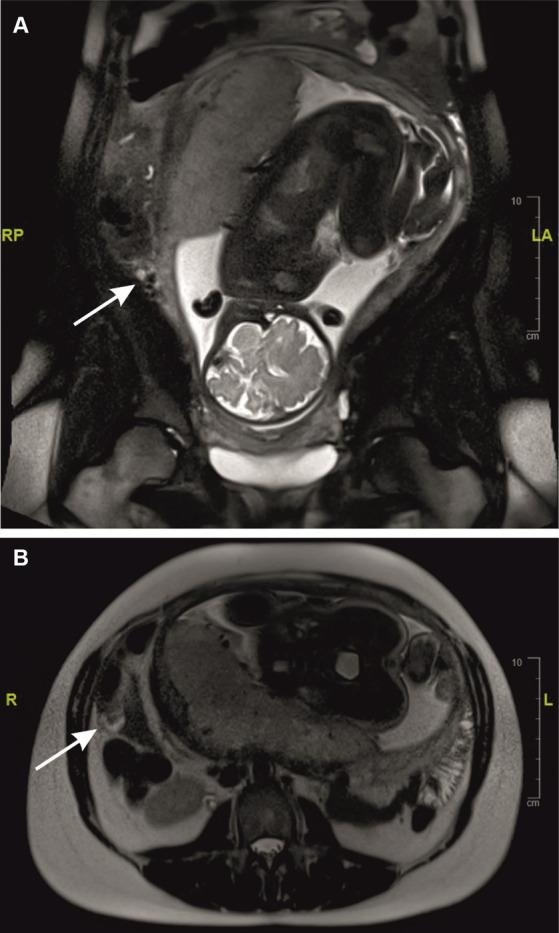 https://cdn.ncbi.nlm.nih.gov/pmc/blobs/4dc5/11251912/1a171368b63d/fmed-11-1387043-g002.jpg