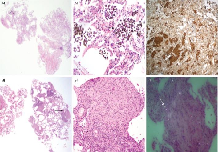 https://cdn.ncbi.nlm.nih.gov/pmc/blobs/4dc7/5360885/631f46b2294e/00148-2016.03.jpg