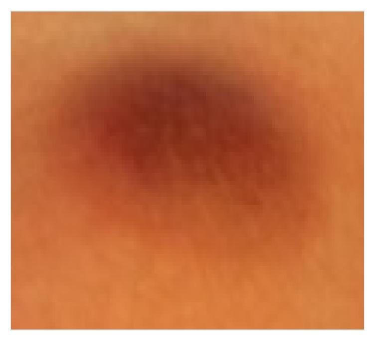 https://cdn.ncbi.nlm.nih.gov/pmc/blobs/4dca/4563086/7065ccf98ad6/CRIONM2015-429068.001.jpg