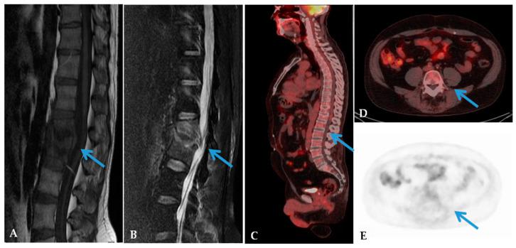 https://cdn.ncbi.nlm.nih.gov/pmc/blobs/4dca/7290470/0814f95fb108/jcm-09-01581-g002.jpg