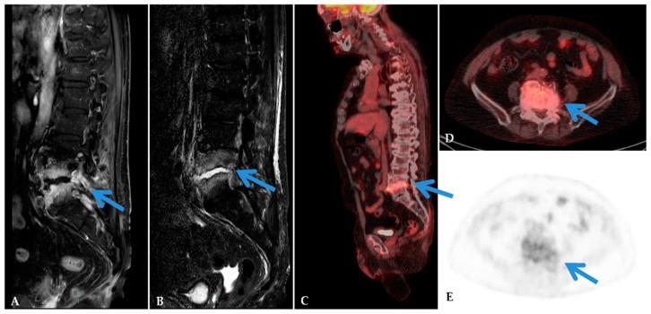 https://cdn.ncbi.nlm.nih.gov/pmc/blobs/4dca/7290470/8a1d04e989c8/jcm-09-01581-g001.jpg
