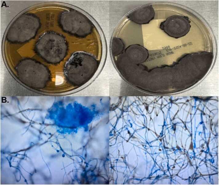 https://cdn.ncbi.nlm.nih.gov/pmc/blobs/4dd0/12191293/21ff4c47c078/gr3.jpg