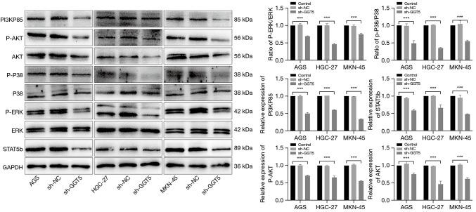 https://cdn.ncbi.nlm.nih.gov/pmc/blobs/4dd5/11385246/641dd94c669f/tcr-13-08-4459-f4.jpg