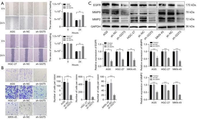 https://cdn.ncbi.nlm.nih.gov/pmc/blobs/4dd5/11385246/ac33ebacf4fa/tcr-13-08-4459-f5.jpg