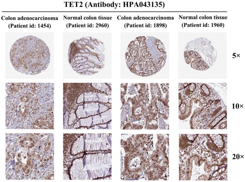 https://cdn.ncbi.nlm.nih.gov/pmc/blobs/4dd9/10861813/f8e9fedaf9fd/jcav15p1414g006.jpg