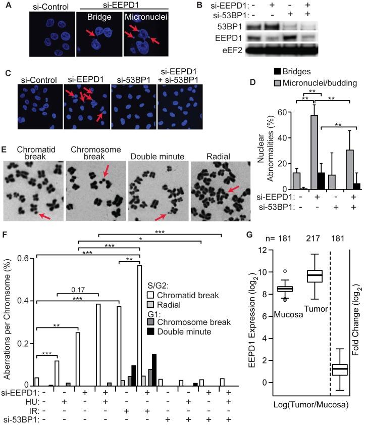 https://cdn.ncbi.nlm.nih.gov/pmc/blobs/4dda/4684289/b2df4ce5e862/pgen.1005675.g007.jpg